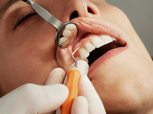 What is gum disease?