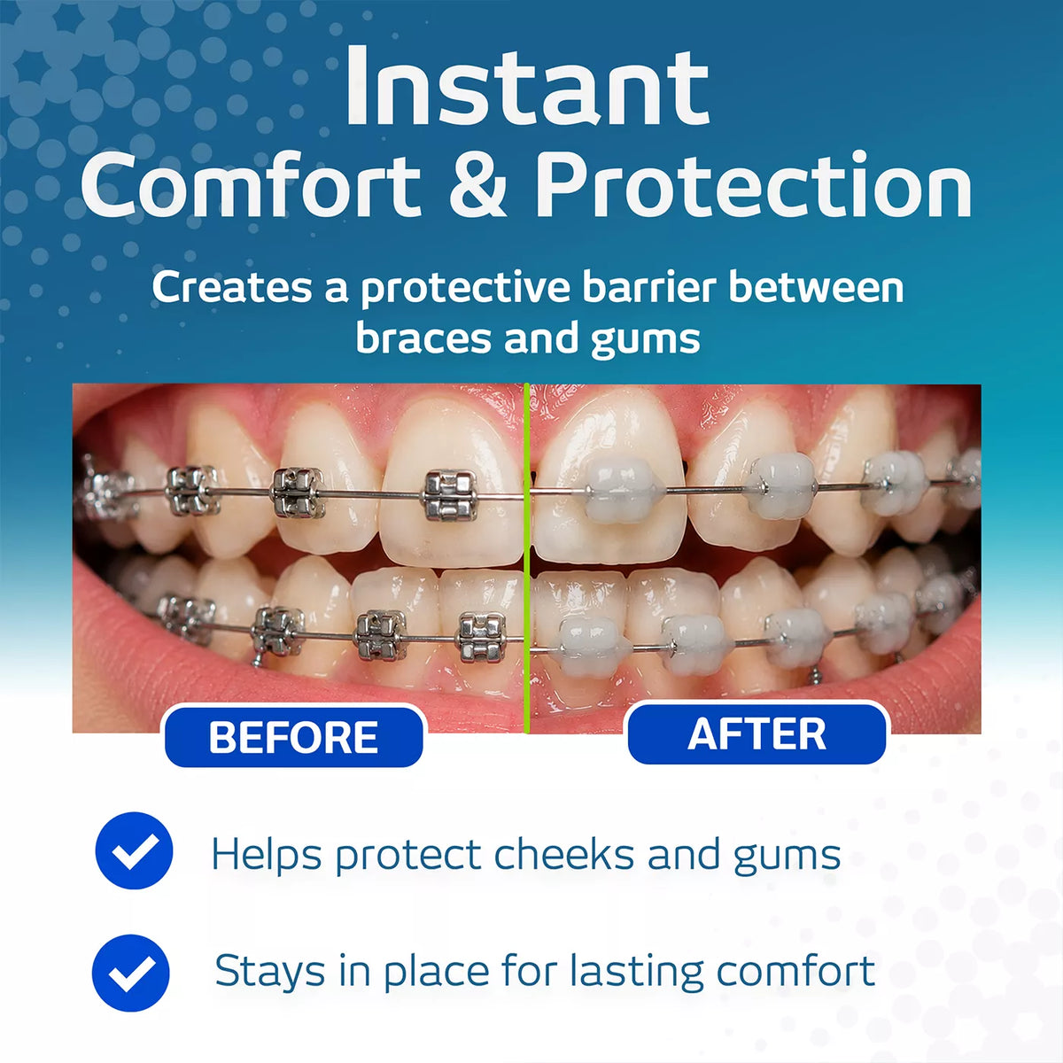 VITIS Orthodontic Wax (2 Pack)