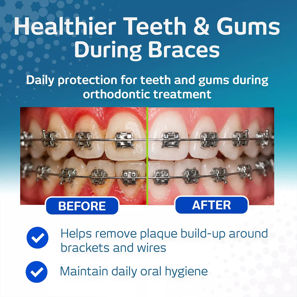 VITIS Orthodontic Travel Kit (Toothbrush, Toothpaste, Mouthwash, Wax)