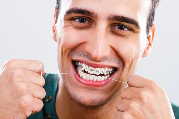 How to Keep Braces Clean