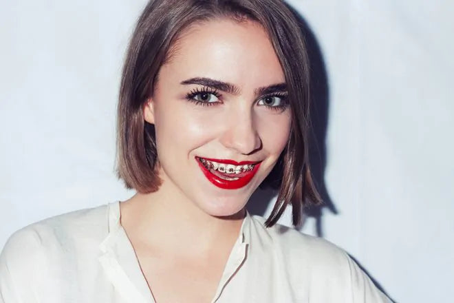 Braces – What are the options?