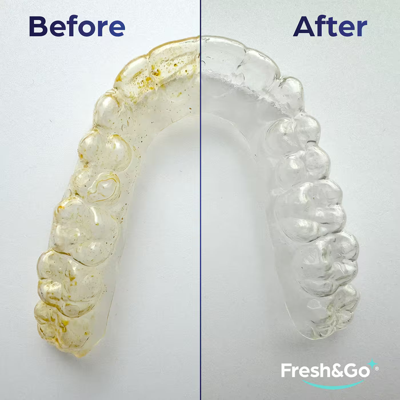 Fresh & Go Aligner and Retainer Cleaning Tablets (36)