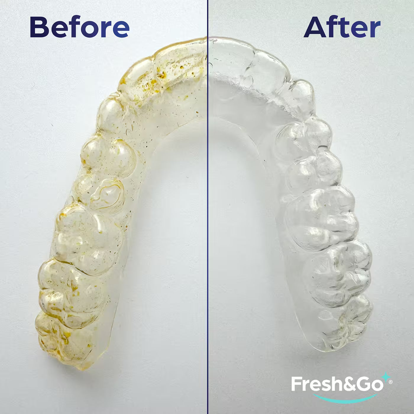 Fresh & Go Aligner and Retainer Cleaning Tablets (96)