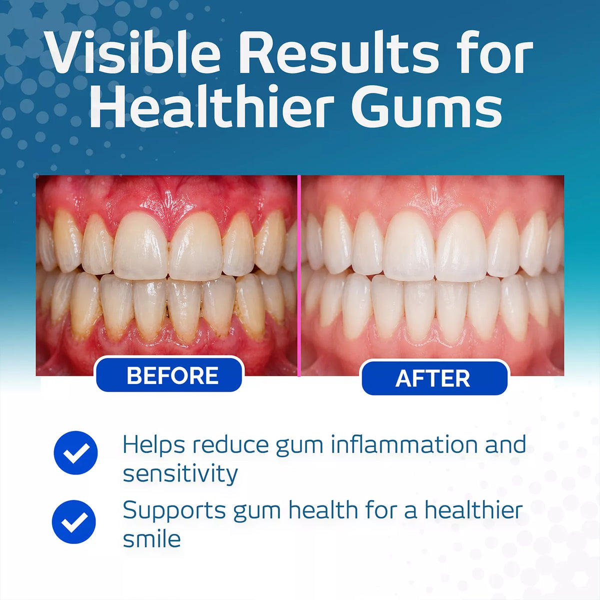 VITIS Healthy Gums Mouthwash