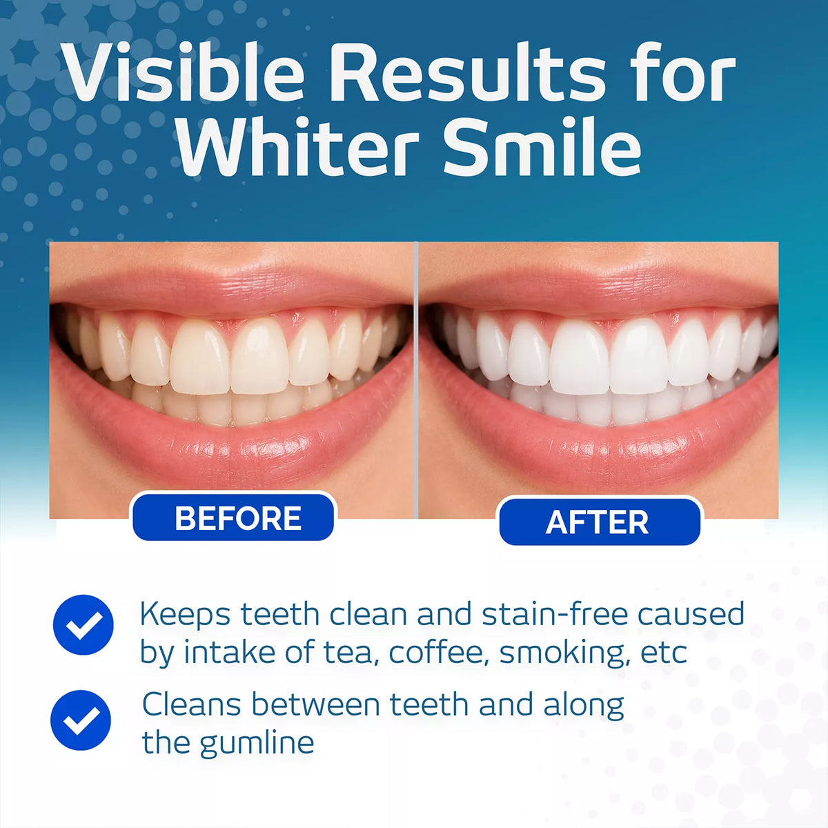 VITIS Whitening Mouthwash