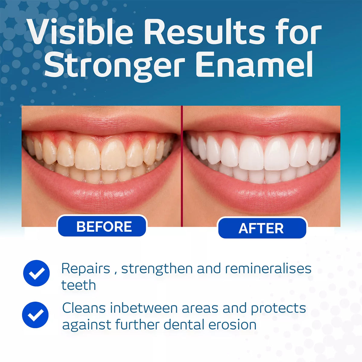 VITIS Anti-Caries Toothpaste